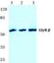 Glycine Receptor Beta antibody, PA5-36958, Invitrogen Antibodies, Western Blot image 