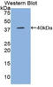 C-C Motif Chemokine Ligand 5 antibody, LS-C296204, Lifespan Biosciences, Western Blot image 