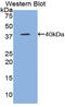 C-C motif chemokine 5 antibody, LS-C296204, Lifespan Biosciences, Western Blot image 