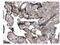 FAS antibody, GTX52493, GeneTex, Immunohistochemistry paraffin image 