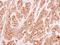 Protein kinase domain-containing protein, cytoplasmic antibody, NBP2-19960, Novus Biologicals, Immunohistochemistry paraffin image 