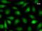 CBFA2/RUNX1 Partner Transcriptional Co-Repressor 2 antibody, LS-C342297, Lifespan Biosciences, Immunofluorescence image 