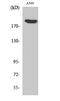 Zinc Finger CCCH-Type Containing 13 antibody, A11022-1, Boster Biological Technology, Western Blot image 