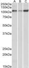 ATPase Sarcoplasmic/Endoplasmic Reticulum Ca2+ Transporting 2 antibody, STJ72774, St John