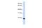 Claudin 19 antibody, GTX47764, GeneTex, Western Blot image 