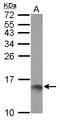 TFF1 antibody, LS-C155659, Lifespan Biosciences, Western Blot image 