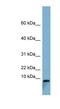 T Cell Leukemia Translocation Altered antibody, NBP1-59828, Novus Biologicals, Western Blot image 