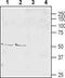 Solute Carrier Family 1 Member 6 antibody, TA328840, Origene, Western Blot image 