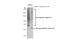 Glypican 3 antibody, GTX633410, GeneTex, Western Blot image 