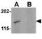Synaptopodin 2 antibody, GTX85139, GeneTex, Western Blot image 