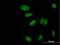 Zinc Finger Protein 133 antibody, H00007692-B02P, Novus Biologicals, Immunocytochemistry image 