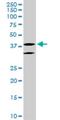 LIM/homeobox protein Lhx6 antibody, H00026468-M05, Novus Biologicals, Western Blot image 