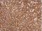 Transketolase antibody, NBP2-20699, Novus Biologicals, Immunohistochemistry paraffin image 