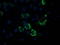 Pyruvate Dehydrogenase E1 Alpha 1 Subunit antibody, LS-C172854, Lifespan Biosciences, Immunofluorescence image 