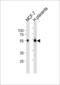 Estrogen Receptor 2 antibody, LS-C157729, Lifespan Biosciences, Western Blot image 