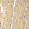 Citrin antibody, LS-C334334, Lifespan Biosciences, Immunohistochemistry paraffin image 