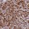 Armadillo Repeat Containing 6 antibody, HPA041681, Atlas Antibodies, Immunohistochemistry frozen image 