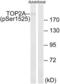 DNA Topoisomerase II Alpha antibody, LS-C199675, Lifespan Biosciences, Western Blot image 