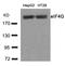 Eukaryotic Translation Initiation Factor 4 Gamma 1 antibody, A01351, Boster Biological Technology, Western Blot image 