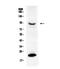 Prolactin Receptor antibody, PA5-79876, Invitrogen Antibodies, Western Blot image 
