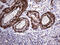 TRNA Methyltransferase 12 Homolog antibody, M15532, Boster Biological Technology, Immunohistochemistry paraffin image 