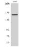 RAB3 GTPase Activating Non-Catalytic Protein Subunit 2 antibody, A07244-2, Boster Biological Technology, Western Blot image 