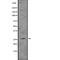 Linker For Activation Of T Cells antibody, abx216526, Abbexa, Western Blot image 