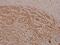 SRC Proto-Oncogene, Non-Receptor Tyrosine Kinase antibody, A00107Y529, Boster Biological Technology, Immunohistochemistry paraffin image 