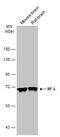 Neurofilament Light antibody, GTX134085, GeneTex, Western Blot image 