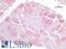 Interleukin 6 Receptor antibody, LS-A10886, Lifespan Biosciences, Immunohistochemistry paraffin image 