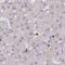 Bridging Integrator 2 antibody, PA5-58486, Invitrogen Antibodies, Immunohistochemistry frozen image 