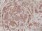 Actinin Alpha 4 antibody, M01975-1, Boster Biological Technology, Immunohistochemistry paraffin image 