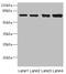 Leucine Rich Repeat And Ig Domain Containing 1 antibody, LS-C675995, Lifespan Biosciences, Western Blot image 