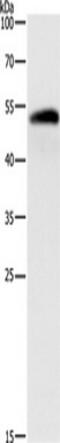 Aldehyde Dehydrogenase 1 Family Member B1 antibody, TA350847, Origene, Western Blot image 