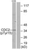 Cyclin Dependent Kinase 1 antibody, LS-C117314, Lifespan Biosciences, Western Blot image 