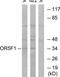 Olfactory Receptor Family 5 Subfamily F Member 1 antibody, TA316341, Origene, Western Blot image 