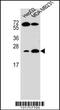 Ras Homolog Family Member J antibody, 56-029, ProSci, Western Blot image 