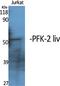 6-Phosphofructo-2-Kinase/Fructose-2,6-Biphosphatase 1 antibody, A08398, Boster Biological Technology, Western Blot image 