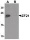 Zinc Finger FYVE-Type Containing 21 antibody, PA5-34408, Invitrogen Antibodies, Western Blot image 