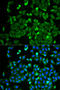 Neurofibromin 2 antibody, STJ28273, St John