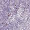 C-X-C motif chemokine 5 antibody, NBP2-39058, Novus Biologicals, Immunohistochemistry frozen image 