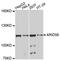 AT-Rich Interaction Domain 5B antibody, abx126831, Abbexa, Western Blot image 