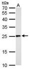 NADH:Ubiquinone Oxidoreductase Core Subunit V2 antibody, GTX102259, GeneTex, Western Blot image 