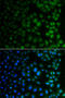 N(Alpha)-Acetyltransferase 40, NatD Catalytic Subunit antibody, STJ29522, St John