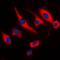 TNF Alpha Induced Protein 8 antibody, orb215103, Biorbyt, Immunocytochemistry image 