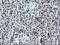 Tumor Protein P73 antibody, LS-C174783, Lifespan Biosciences, Immunohistochemistry paraffin image 