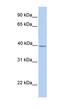 SAM Domain, SH3 Domain And Nuclear Localization Signals 1 antibody, orb330456, Biorbyt, Western Blot image 