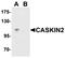 CASK Interacting Protein 2 antibody, orb75720, Biorbyt, Western Blot image 