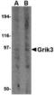 Glutamate receptor, ionotropic kainate 3 antibody, TA306497, Origene, Western Blot image 