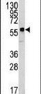 Kringle Containing Transmembrane Protein 1 antibody, PA5-14549, Invitrogen Antibodies, Western Blot image 